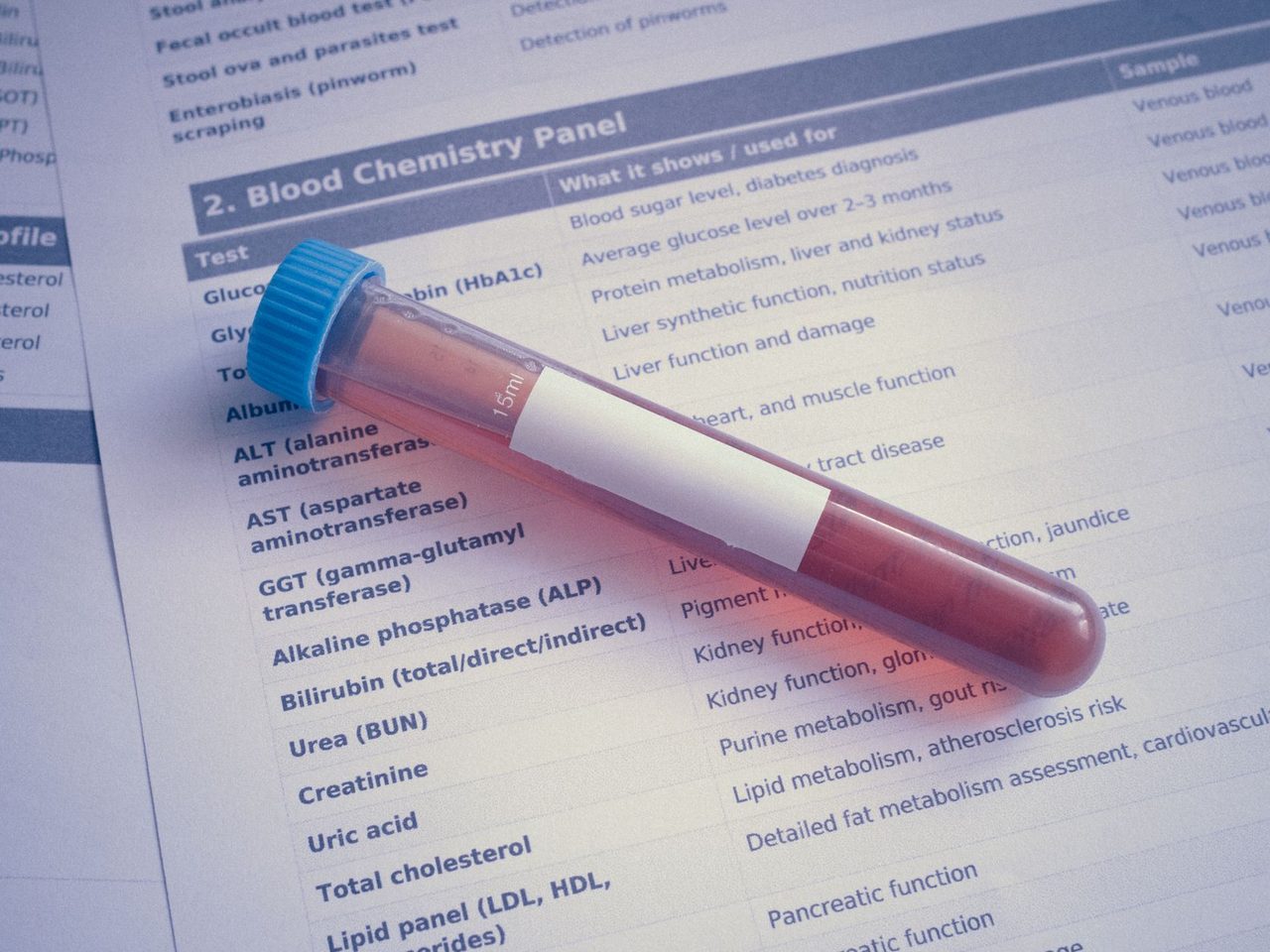 A blood sample tube with a blue cap lying on a printed blood chemistry panel