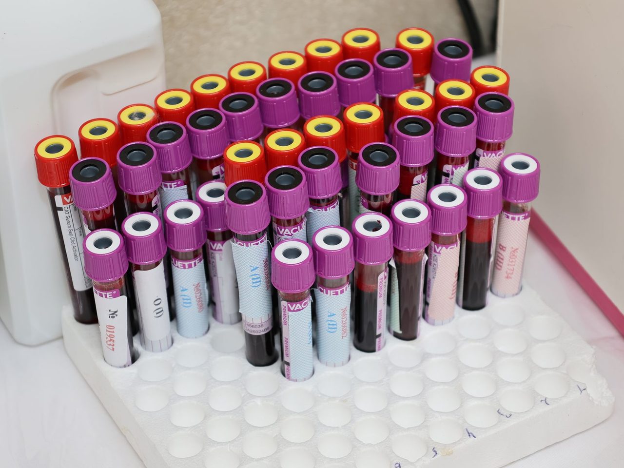 Rows of blood collection tubes with colored caps standing in a white rack