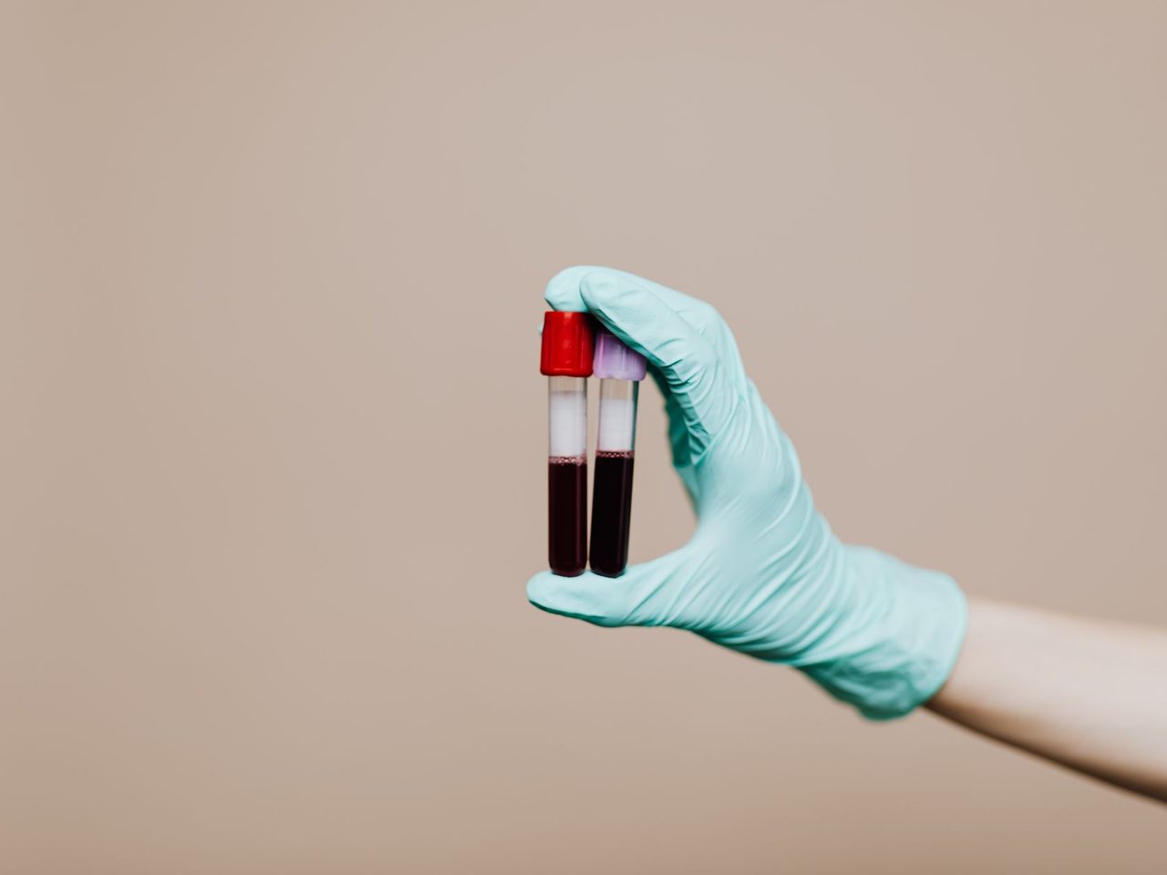A gloved hand holding two blood sample tubes against a beige background